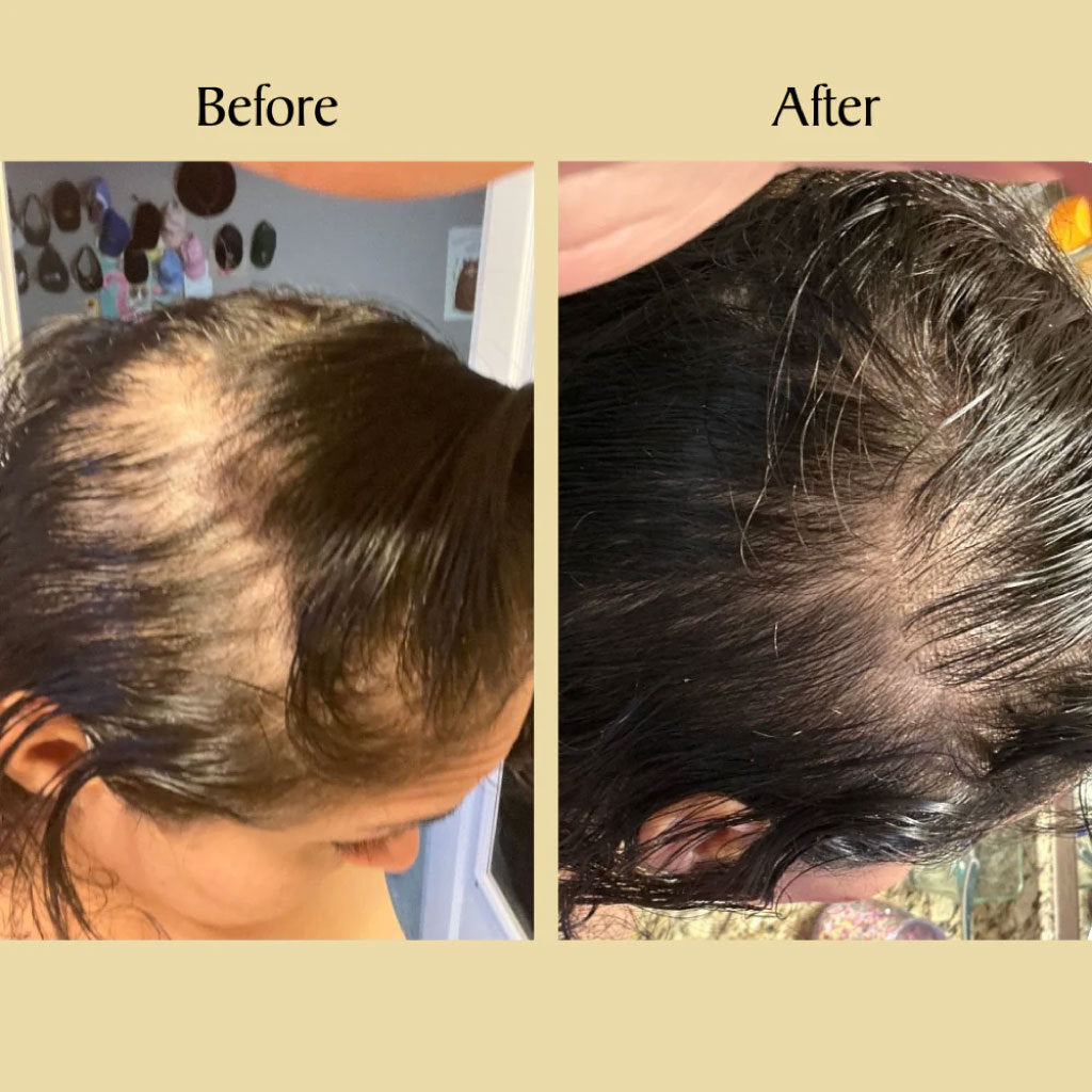 Vegan Rosemary Hair Growth Essential Oil
